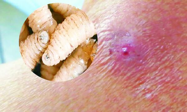 barrenador-EN-HUMANOS-1024x580